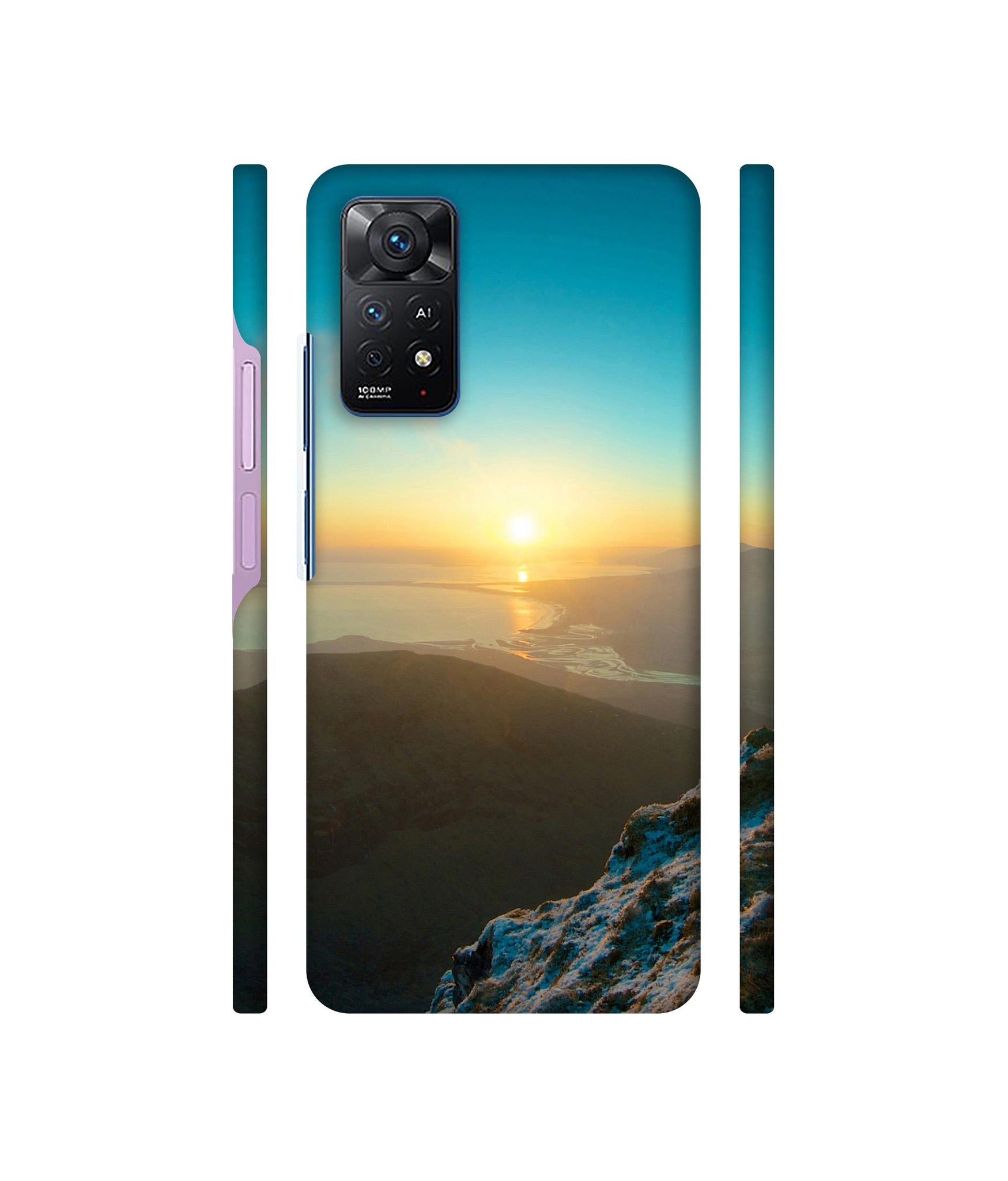 Senset Designer Hard Back Cover for Mi Redmi Note 11 Pro Plus 5G
