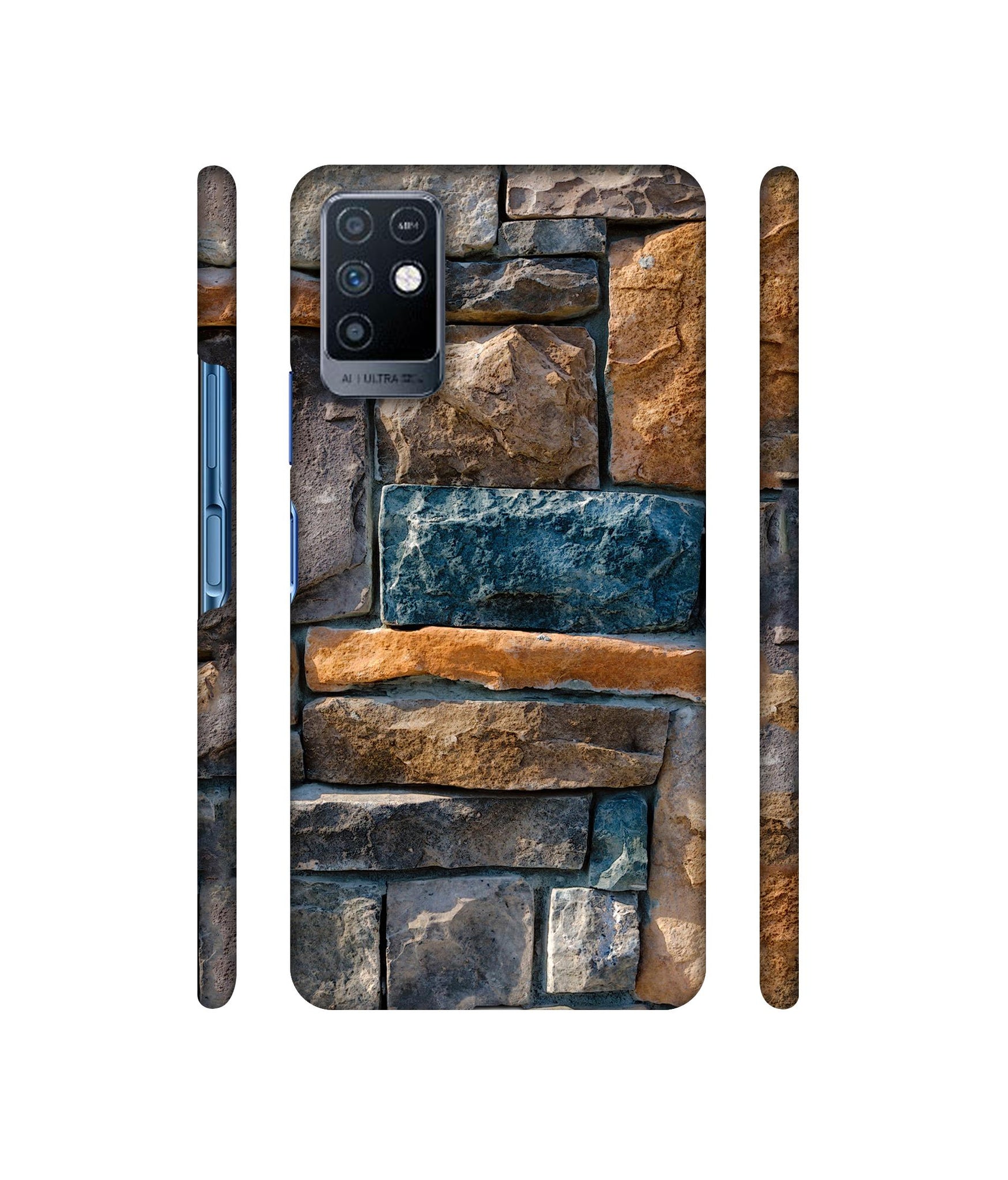 Decorative Stone Cladding Designer Hard Back Cover for Infinix Note 10